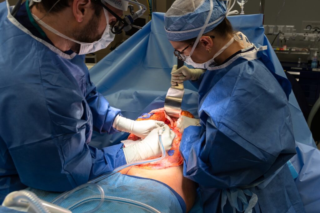 Dr Bloom in Chicago performing muscle repair during an abdominoplasty