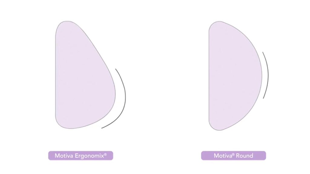 Illustration of the shape difference between Motiva Ergonomix and Motiva Round